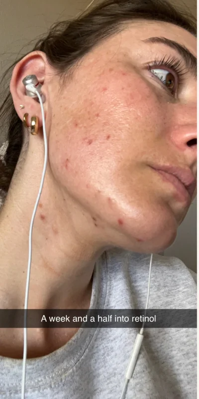 Before: ZO Skin Health